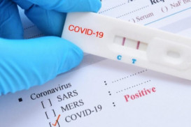 Türkiyəyə gedən bəzi şəxslərdən koronavirus testi - Tələb Edilməyəcək